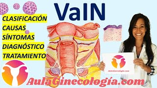 VaIN Neoplasia Intraepitelial de Vagina DIAGNÓSTICO y MANEJO   Ginecología y Obstetricia [upl. by Ecart]