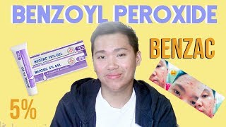 Benzac Benzoyl Peroxide 5 Review for Acne Philippines [upl. by Prebo769]