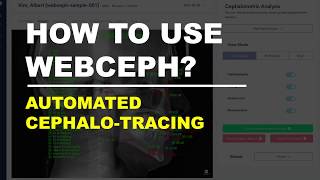 How to use WEBCEPH Automated Cephalometric Tracing [upl. by Alael]