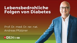 75 der Diabetiker sterben an den Folgen ihrer Erkrankung  Prof Dr med Andreas Pfützner  QS24 [upl. by Kent]