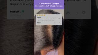 Get Rid of Dandruff using this dandruffshampoo ketoconazoleshampoo [upl. by Halbert194]