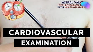 Cardiovascular Examination  OSCE Guide  UKMLA  CPSA [upl. by Clothilde]