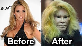 20 Celebrity Plastic Surgery Disasters [upl. by Alekim]