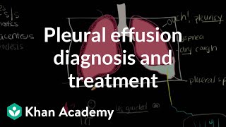 Pleural effusion diagnosis and treatment  Respiratory system diseases  NCLEXRN  Khan Academy [upl. by Nigrom93]