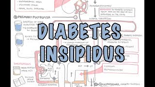 Diabetes Insipidus  Overview causes pathophysiology investigations [upl. by Margie485]