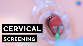 Cervical Screening Smear  HPV  OSCE Guide  UKMLA  CPSA [upl. by Yoral]