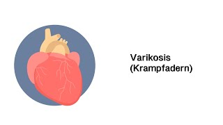 Varikosis Krampfadern  Erkrankungen der Gefäße und des Kreislauf [upl. by Regdor]