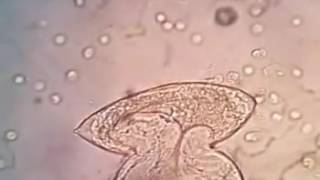 hatching of schistosoma heamatobium miracidium [upl. by Dominik]