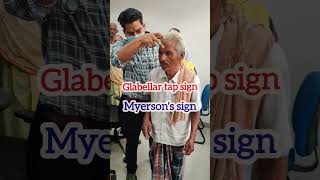 glabellar tap sign in Parkinsons Disease  Myersons sign  Glabellar Reflex mbbs neet [upl. by Pollerd]