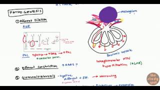 Diabetic Nephropathy for USMLE Step1 and USMLE Step 2 [upl. by Town]