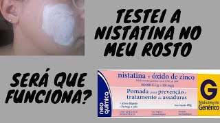 Aplicando a Pomada Nistatina no Rosto  Melasma  Acne PomadaNistatinaOxidodeZinco [upl. by Enaile]