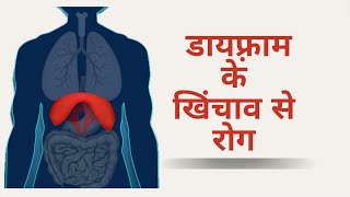 diaphragm के हिस्से में खिंचाव होने से क्या क्या रोग हो सकते है  नाभि का खिसकना मनोवैज्ञानिक रोग [upl. by Alhan521]