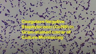 Coagulase Negative Staphylococci CoNS in Gram stained smear of culture Microscopy [upl. by Lagas]