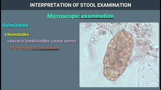 stool microscopy specimens  part 3 [upl. by Nerrej]