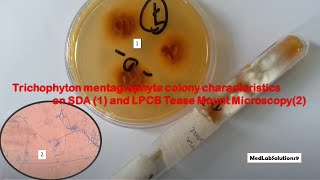 Trichophyton mentagrophyte colony characteristics on SDA and LPCB Microscopy [upl. by Eelahc]