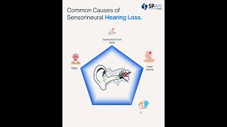 Common Causes of Sensorineural Hearing Loss [upl. by Becker]