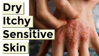 8 Things to Avoid With Eczema and Dry Itchy or Sensitive Skin [upl. by Standing]