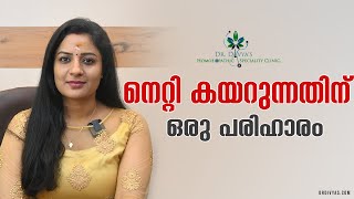 നെറ്റി കയറുന്നതിന് ഒരു പരിഹാരം  How To Treat Forehead Hair Loss  Hair Treatments For Men amp Woman [upl. by Lehcar]