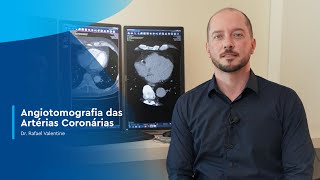 Angiotomografia das Artérias Coronárias  Dr Rafael Valentini [upl. by Anayd987]