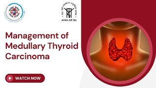 Management of Medullary Thyroid Carcinoma [upl. by Eibrab]