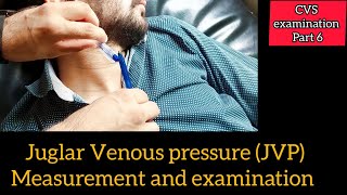 JVP Jugluar Venous Pulse Examination and measurement  CVS examination part 6 [upl. by Delainey]