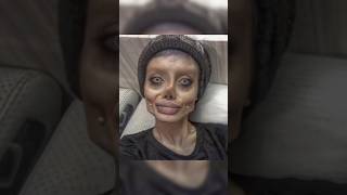 😱Extreme Plastic Surgery Fails viral new tiktok asmr art trending like satisfying shorts [upl. by Morril]