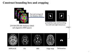 Thalamus Segmentation Using Convolutional Neural Network  SPIE 2021 [upl. by Ecienal]