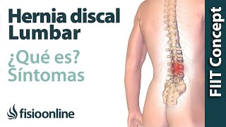 ¿Qué es una HERNIA discal LUMBAR💥y cuáles son sus SÍNTOMAS y CAUSAS FIIT CONCEPT🍃 [upl. by Ardnuahc]