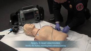 Transcutaneous Pacing [upl. by Clyve]