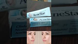 acnestar gel review  acnestar gel kaise use kare youtubeshorts shortsvideo shorts ytshorts [upl. by Annahaj]