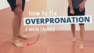 Pronated Feet and How to Fix 3 Different Causes of OVERPRONATION [upl. by Marcell]