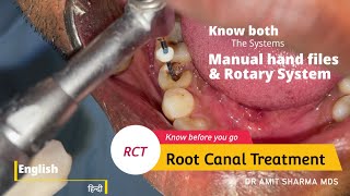 How Root canal treatment  RCT is done  Know both Manual and Rotary system [upl. by Iaoh]