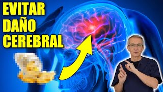 Toma esto INMEDIATAMENTE después de un DERRAME CEREBRAL [upl. by Tsiuqram]