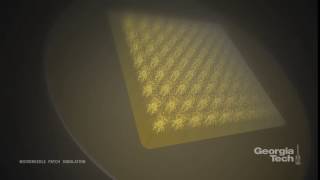 Simulation of the microneedle patch for flu vaccination [upl. by Nolubez87]