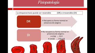 Anemia de celulas falciformes [upl. by Rozina521]