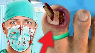 MOST DISGUSTING GAME EVER MADE  Ingrown Toenail Surgery Game [upl. by Gusba79]