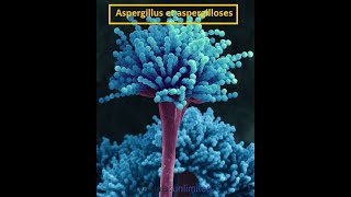 Parasitologie Lexplication la plus facile de laspargillose [upl. by Ocnarfnaig601]