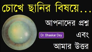 Cataract Surgery Questions cataract cataractSurgery cataractOperation cataractSurgeryQuestions [upl. by Mastic]