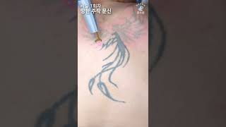 망한 주작 문신제거 Laser Tattoo Removal [upl. by Bergwall262]