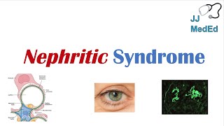 Nephritic Syndrome  Clinical Presentation Causes and Treatment [upl. by Leonteen555]