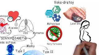 VOKADRATSINNY DIABETA Acidose lactique MG  Centre de Santé MAHEFA [upl. by Novy]