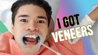 VENEERS Procedure Philippines 2019 [upl. by Ji]