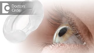 Can multifocal lens be removed if I don’t like it  Dr Sriram Ramalingam [upl. by Adnaloy973]