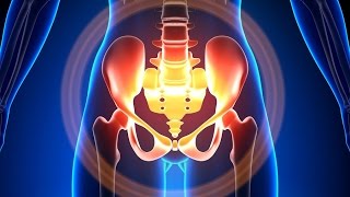 Wise Anderson Protocol  A Headache in the Pelvis [upl. by Atnahsa]