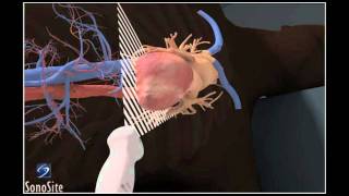 How To Apical 4Chamber View Echocardiography 3D Video [upl. by Perron]