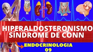 HIPERALDOSTERONISMO SÍNDROME DE CONN  ENDOCRINOLOGIA [upl. by Burrill]