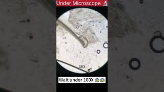 under microscope amoebaunder microscope chickenunder microscope skinshorts videos youtubeshorts [upl. by Ecraep]