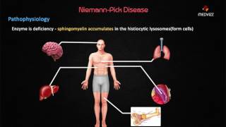 NiemannPick Disease  Case Based discussion  Usmle step 1 Biochemistry [upl. by Emarej]