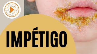 IMPETIGO  ¿Qué es Descubre los síntomas y su prevención [upl. by Kaycee]