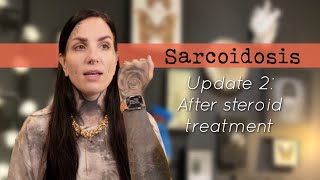 Sarcoidosis update 2 After topical steroid treatment [upl. by Annoik]